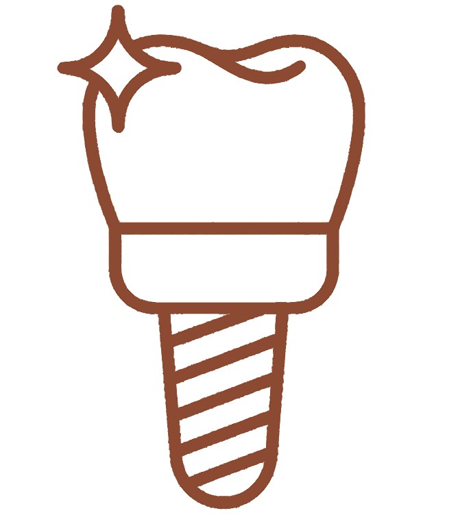 Implantes dentários