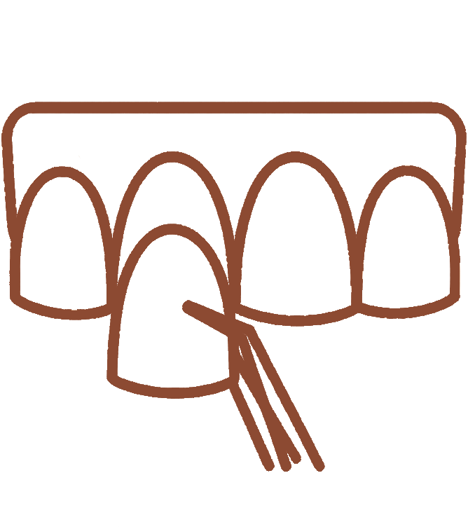 Lentes de contato dental