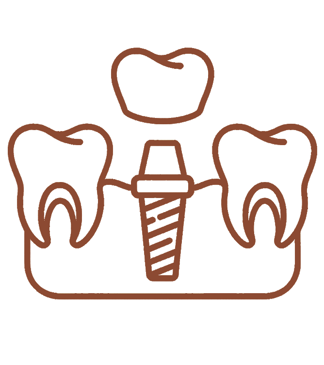 Próteses sobre Implante