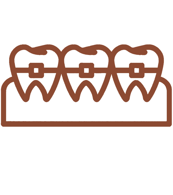 Ortodontia com Alinhadores